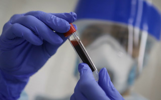 Как иммунитет борется с коронавирусом: выяснили новый факт