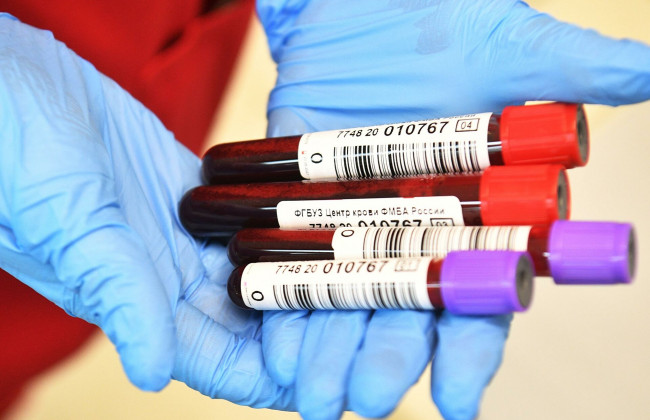 Назвали наиболее уязвимые перед COVID-19 группы крови