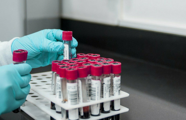 Ученые обнаружили удивительную находку – антитело, нейтрализующее COVID-19