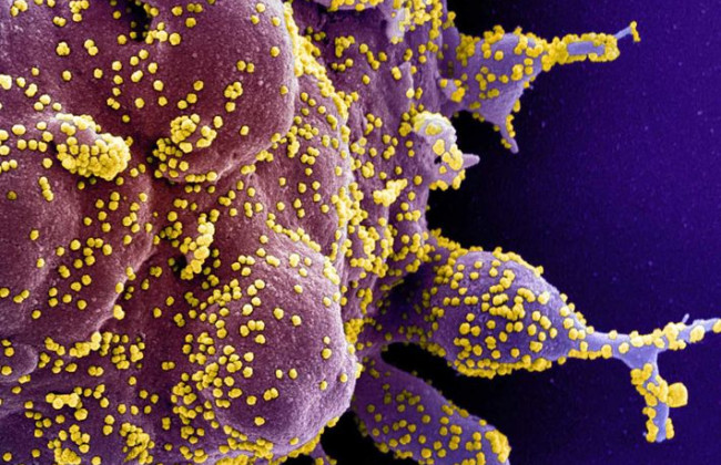 Станет ли Covid-19 менее опасным по мере своего развития