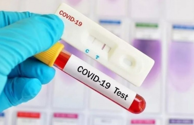 COVID-статистика: в Украине вновь выявили свыше 10 тысяч случаев