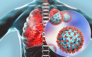 Стало известно, приводит ли «Омикрон» к воспалению легких