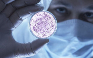 Кишечная палочка снижает риск летального исхода от COVID-19: ученые