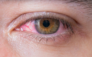 Врачи назвали очень редкий симптом коронавируса