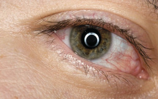 Поражает глаза: назвали странный симптом штамма «Омикрон»