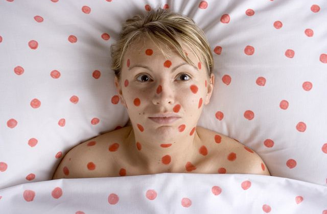 Назван симптом коронавируса, заметный на коже