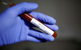 В Украине выявили почти 13 тысяч случаев заражения коронавирусом