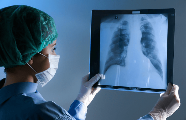 Врач попытался продать рентгеновский снимок пациента в виде NFT