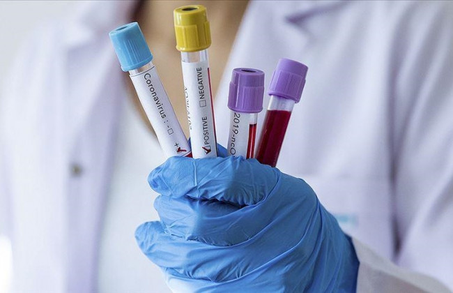 Симптомы штамма «Омикрон» отличаются от проявлений предыдущих вариантов COVID-19