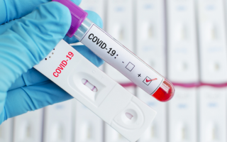 Получили положительный тест на COVID: кого в первую очередь следует предупредить