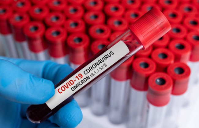 Передается в 7 раз быстрее «Дельты»: назвали главную опасность штамма «Омикрон»