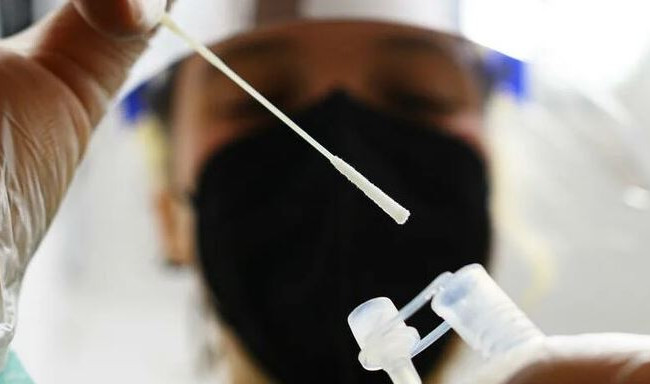 Ученые выявили у перенесших COVID-19 изменения как при болезни Альцгеймера