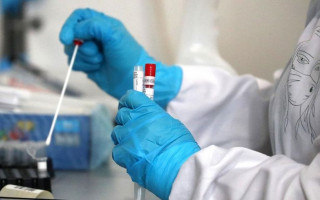 Ученые определили одну из причин тяжелого течения коронавируса