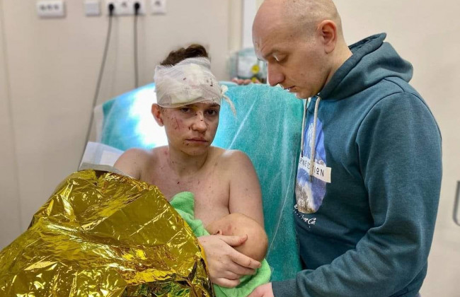 «Українська Мадонна»: жінка під час обстрілу прикрила своїм тілом немовля, фото