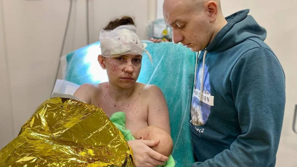 «Українська Мадонна»: жінка під час обстрілу прикрила своїм тілом немовля, фото