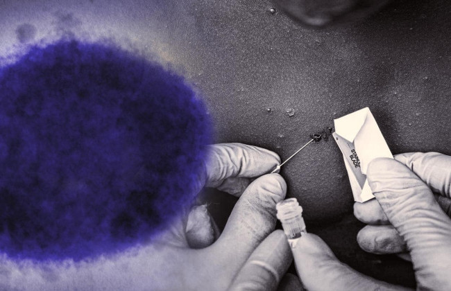 Какие шансы вспышки оспы обезьян в Украине: инфекционист оценил риски