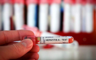 Гепатит неизвестного происхождения обнаружили у детей: что о нем известно