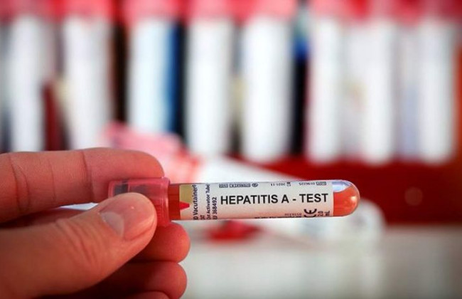 Гепатит неизвестного происхождения обнаружили у детей: что о нем известно