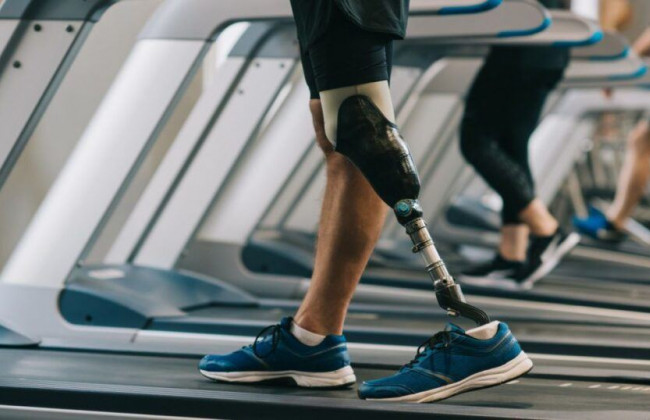 Учасники бойових дій мають право на безкоштовне протезування: які вироби доступні