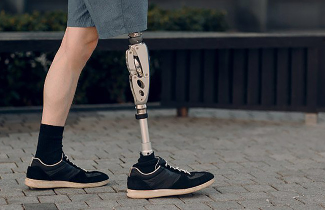 Як отримати допоміжні засоби реабілітації: покрокова інструкція