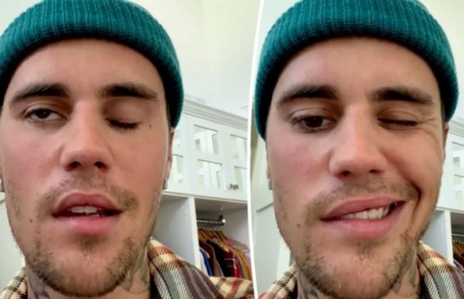 У Джастина Бибера обнаружили синдром Рамсея Ханта: у певца парализовало часть лица