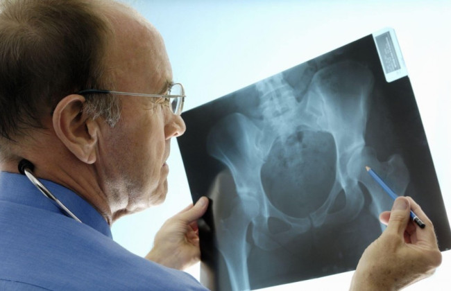 Заволодіння 13 млн грн на постачанні рентгенапаратів: у Києві підозрюють керівника фірми-резидента РФ