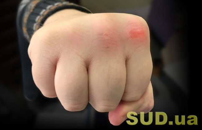 На Дніпропетровщині депутат селищної ради побив місцевого мешканця