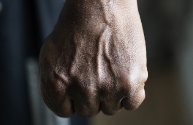 Во Франции избили двух украинок – посольство в Париже взяло дело на особый контроль