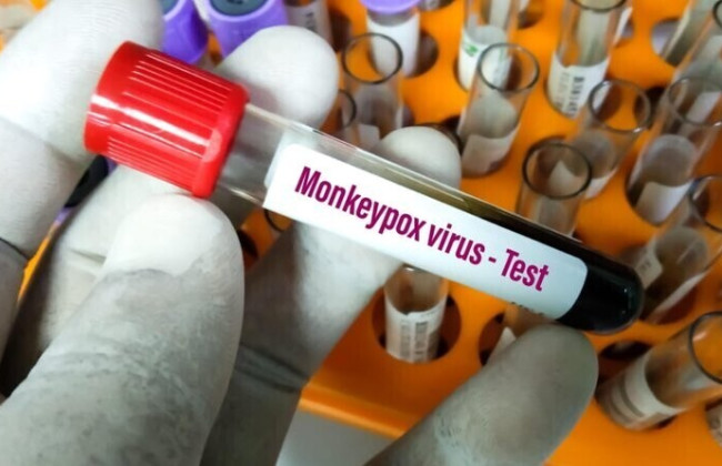 В Украине обнаружили первый случай оспы обезьян