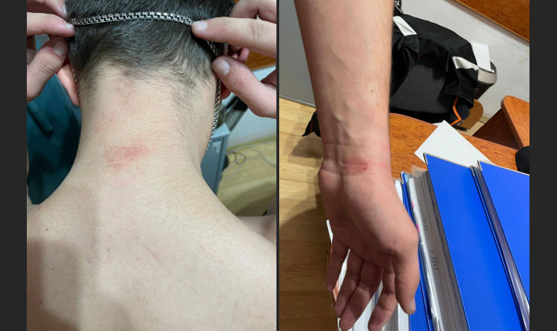 Надели мужчине мешок на голову и били: в Тернопольской области троих правоохранителей подозревают в пытках