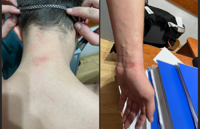 Одягнули чоловіку мішок на голову та били: на Тернопільщині трьох правоохоронців підозрюють у катуванні