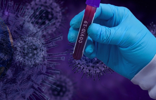 Імунітет до COVID-19 мають близько 90% населення світу, — ВООЗ