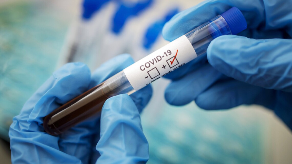 В Украине зафиксировали новый штамм коронавируса «Кракен»: есть первый зараженный