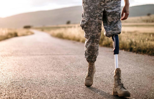Військовим спростять отримання виплати на протезування: що відомо