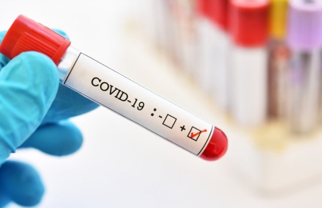 Міненерго США вважає, що коронавірус виник через витік із лабораторії, — WSJ