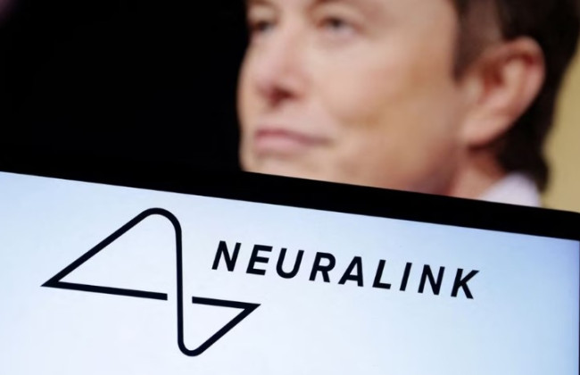 Це не іграшка: компанії Маска заборонили випробовувати мозковий чіп на людях