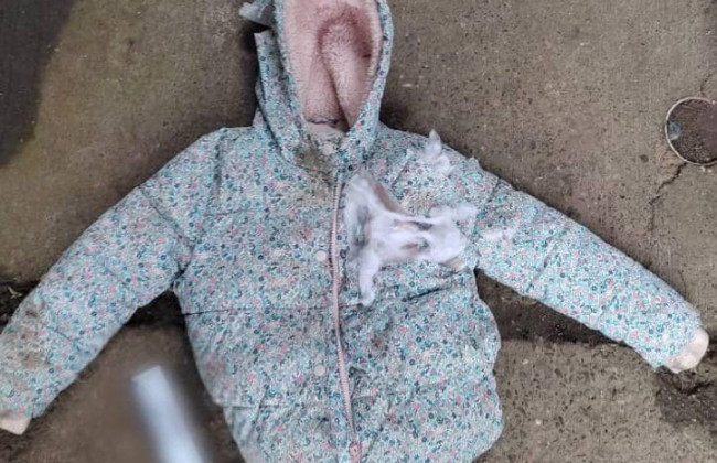 На Київщині собаки напали на матір та 7-річною дитину: їх госпіталізували до лікарні