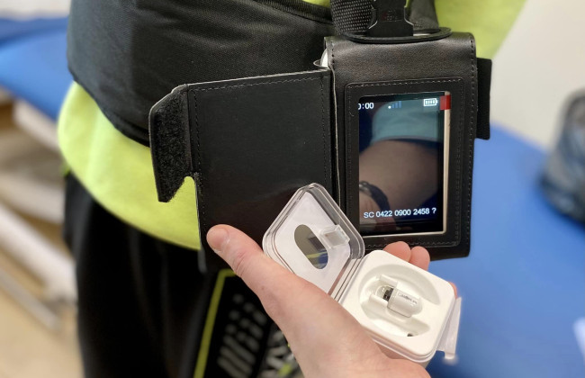 В Україні вперше використали ендокапсулу для обстеження дитини, фото