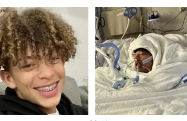 Опасный челлендж в TikTok: в США парень получил ожоги 75% тела