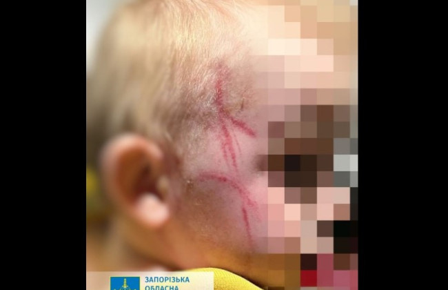 На Запорожье мать избила малыша, потому что тот капризничал во время купания