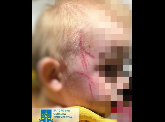 На Запоріжжі матір побила малюка, бо той капризував під час купання