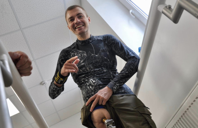 В Україні вдруге військовому вживили протез кістку: історія з центрі «Незламні»