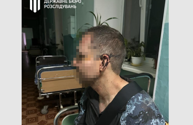 На Одещині у військовій частині побили військовослужбовця: ДБР розпочало розслідування