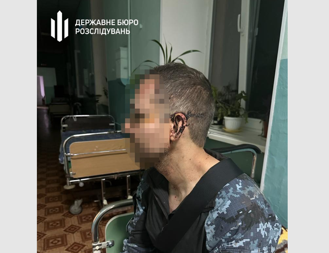 На Одещині у військовій частині побили військовослужбовця: ДБР розпочало розслідування