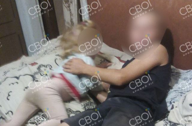 В Кривом Роге у малолетнего мальчика в руках взорвалась батарейка