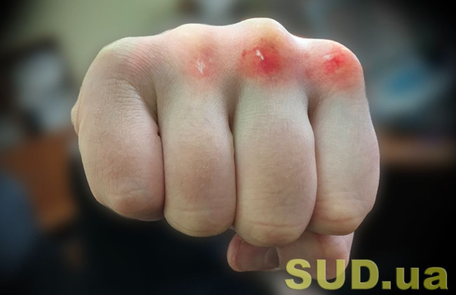 Экс-полицейский предстал перед судом за жестокое избиение мужчины