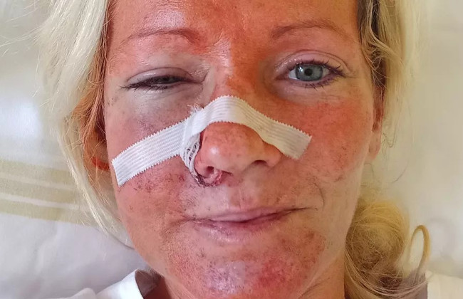 У Чехії чоловік жорстоко побив двох українок за їх національність: подробиці інциденту