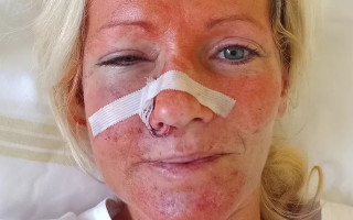 В Чехии мужчина жестоко избил двух украинок за их национальность: подробности инцидента