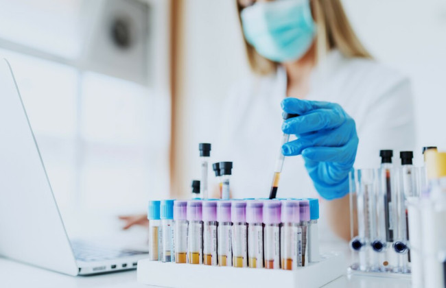 Бесплатные исследования для украинцев: на какие гормоны можно сдать анализы