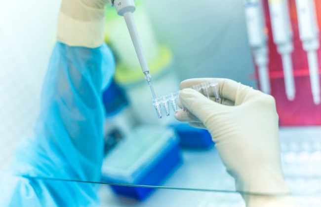 Нідерланди передадуть Україні набори експрес-тестів ДНК для ідентифації дітей, викрадених росією